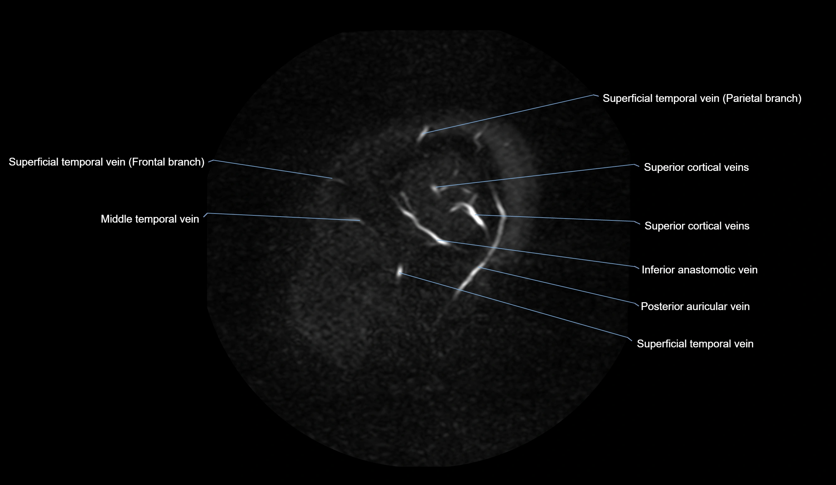 MRV brain sagittal anatomy 3T MRI images -img-01015-00011.webp